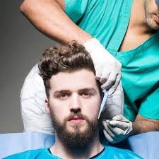 What Preparation Is Needed Before a Mustache Hair Transplant?